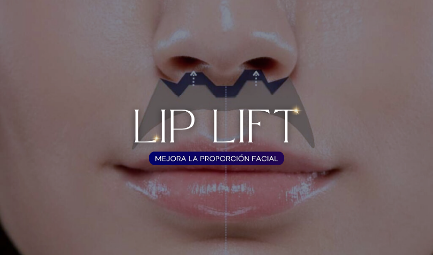 Liplift